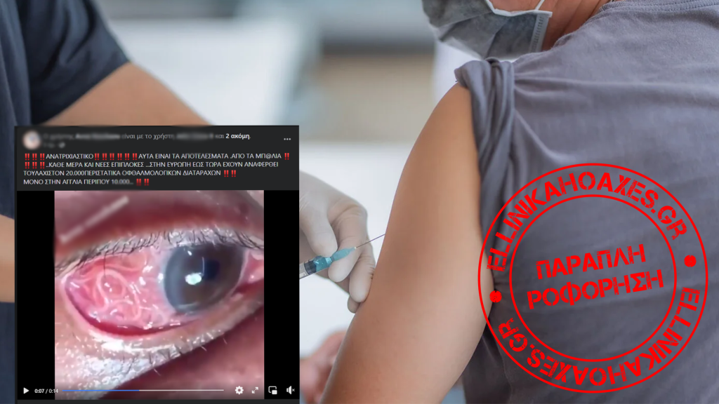 Αυτό το βίντεο ΔΕΝ δείχνει οφθαλμολογικές παρενέργειες εμβολίων για την COVID-19 - Featured image