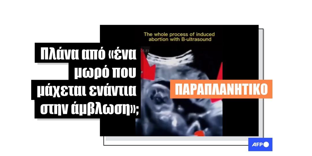 Αυτό το βίντεο που δείχνει ένα «μωρό να παλεύει κατά της άμβλωσης» είναι στην πραγματικότητα από ταινία - Featured image