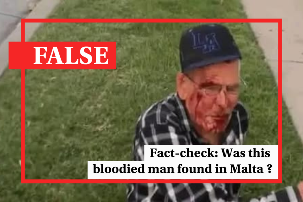 Fact-check: Scam social posts showing injured old man go viral - Featured image