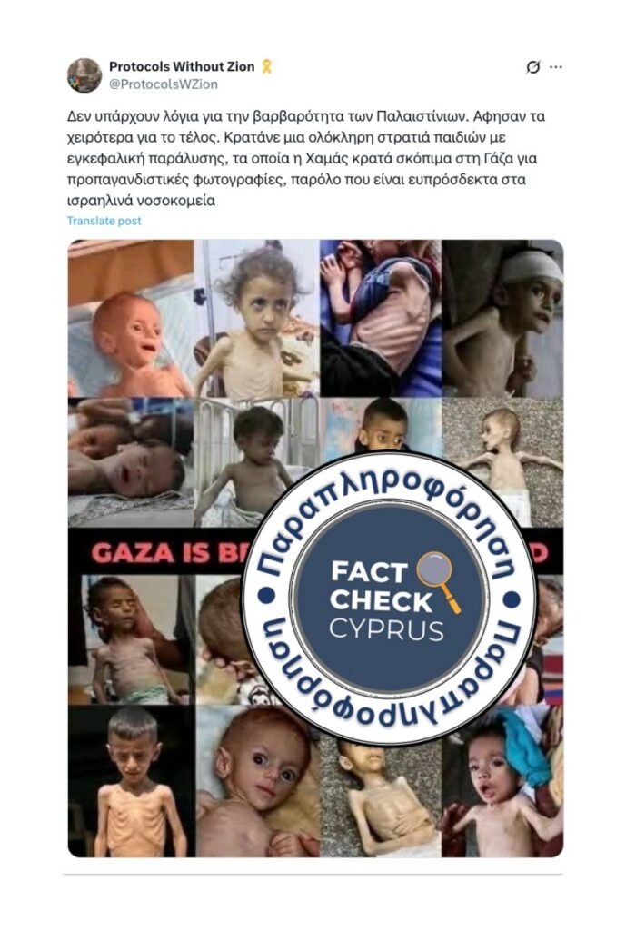 Όχι, ο λιμός στη Γάζα δεν περιορίζεται σε παιδιά με αναπηρίες - Featured image